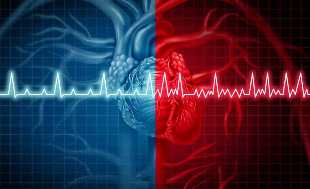 Vad är hjärtflimmer? ViaMedici